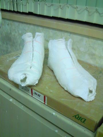 石膏で足の型どり実施①
（石膏といっても石膏を含んだ包帯を巻いて型をとりました）