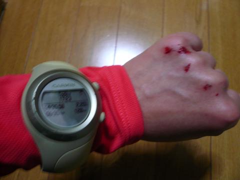 ちょっとピンボケですけど、大事なガーミンに傷がついてるのわかりますか?
機能的には問題ないようなので良かった~。